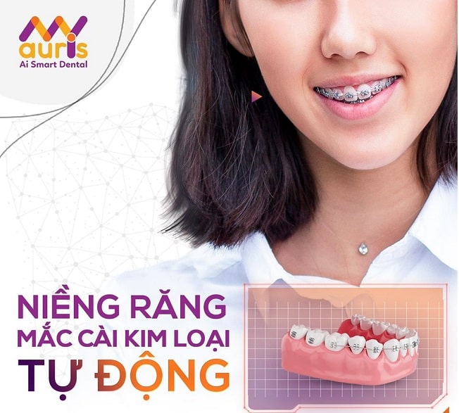 Top 10 địa chỉ niềng răng uy tín tại TP.Hồ Chí Minh - TopBrands