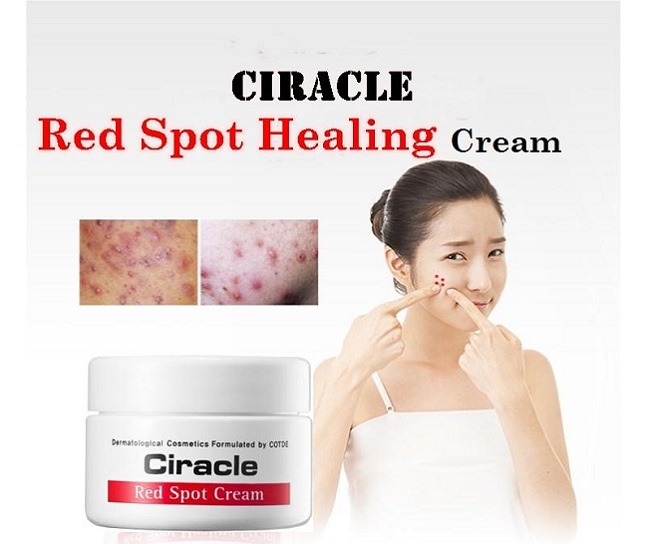 Kem lÃ m giáº£m má»¥n sÆ°ng Ä‘á»�, má»¥n má»§ Ciracle Red Spot Cream 30g
