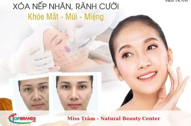 địa chỉ xoá rãnh cười ở TPHCM