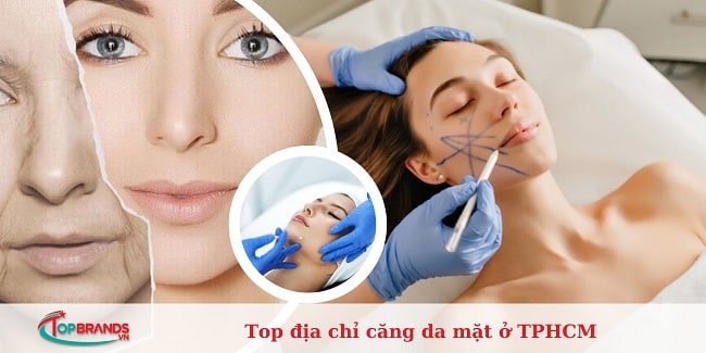 Top 15 địa chỉ căng da mặt ở TPHCM: đẹp, uy tín, an toàn nhất