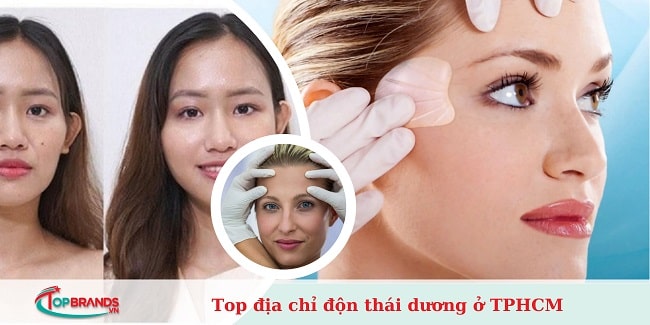 độn thái dương ở TPHCM