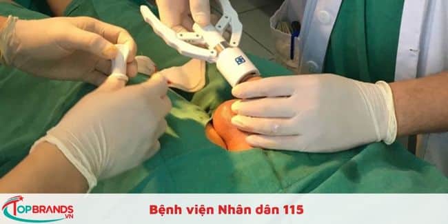 Bệnh viện Nhân dân 115