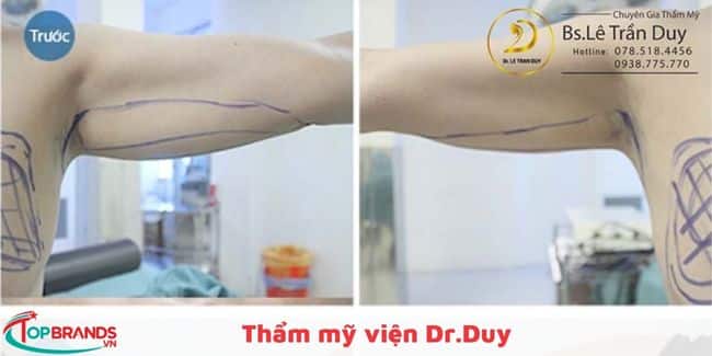 Thẩm mỹ bác sĩ Duy