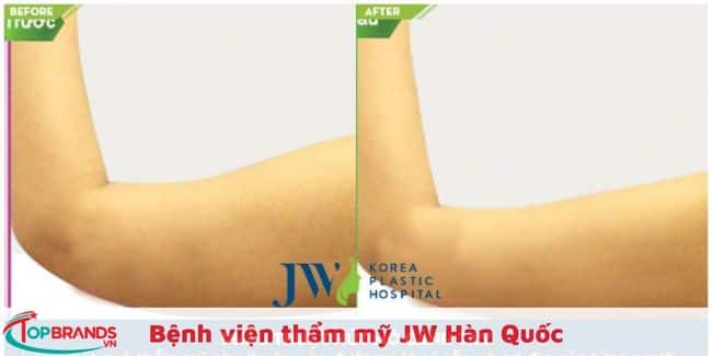 Bệnh viện thẩm mỹ JW Hàn Quốc