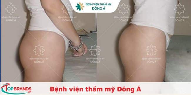 Bệnh viện thẩm mỹ Đông Á