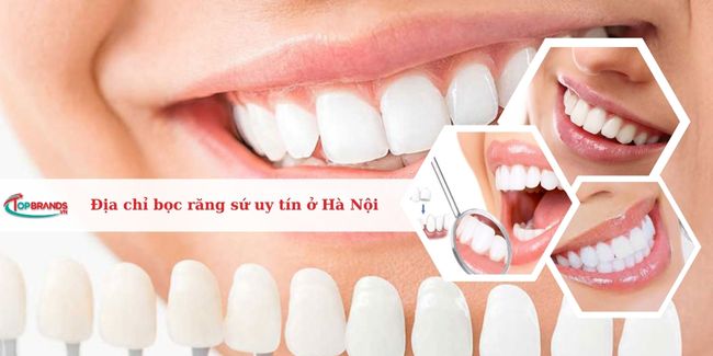 Top 13 địa chỉ bọc răng sứ ở Hà Nội uy tín, tốt nhất