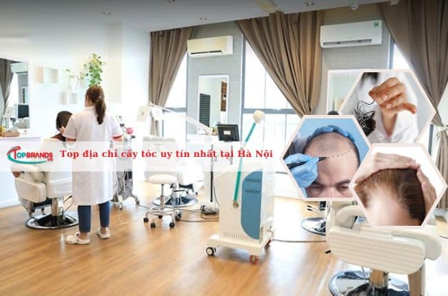 Top địa chỉ cấy tóc uy tín nhất tại Hà Nội