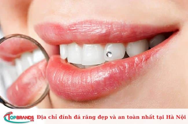 Địa chỉ đính răng tại Hà Nội đẹp và chất lượng