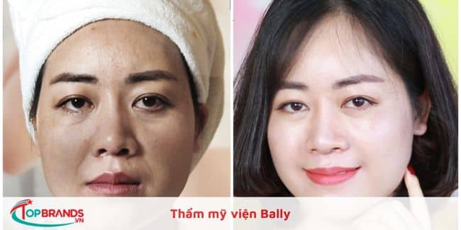 Thẩm mỹ viện Bally