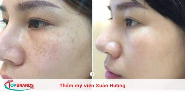 Thẩm mỹ viện Xuân Hương