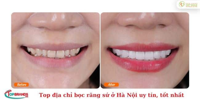 Nha khoa Việt Smile