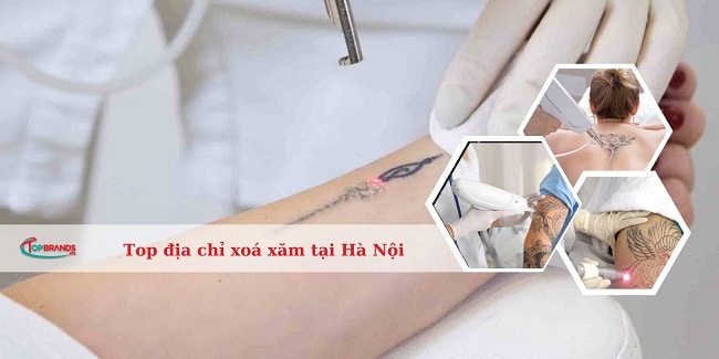 địa chỉ xoá xăm tại Hà Nội uy tín, an toàn