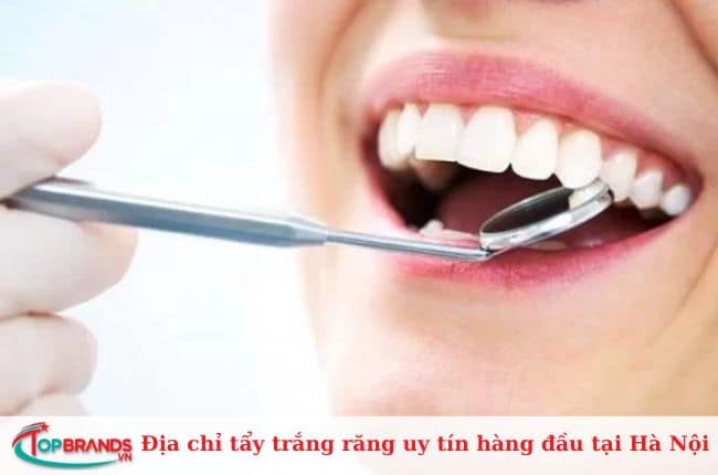 Địa chỉ tẩy trắng răng uy tín ở Hà Nội