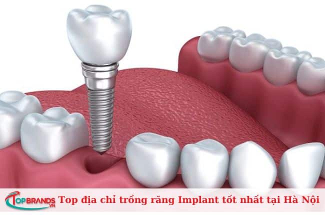 Bệnh viện Răng hàm mặt Trung ương