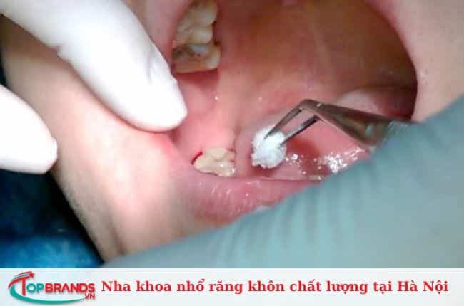 Nha khoa Paris